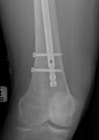leg bottom