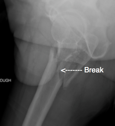 leg break
